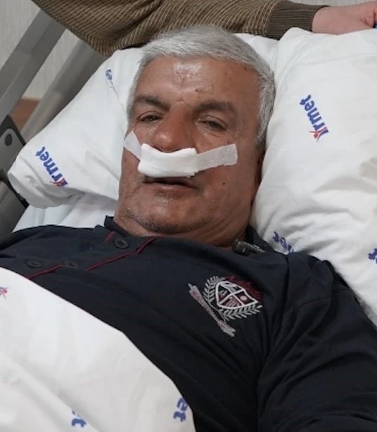 65 yaşındaki adamın burnundan 100 gramlık taş çıkarıldı
