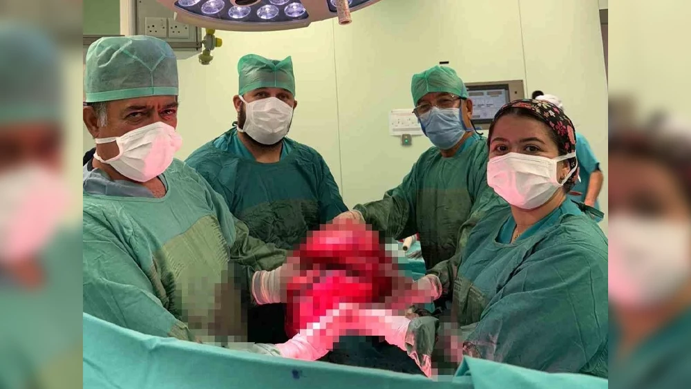 9 Kilogramlık Dev Kitle Başarılı Ameliyatla Çıkarıldı