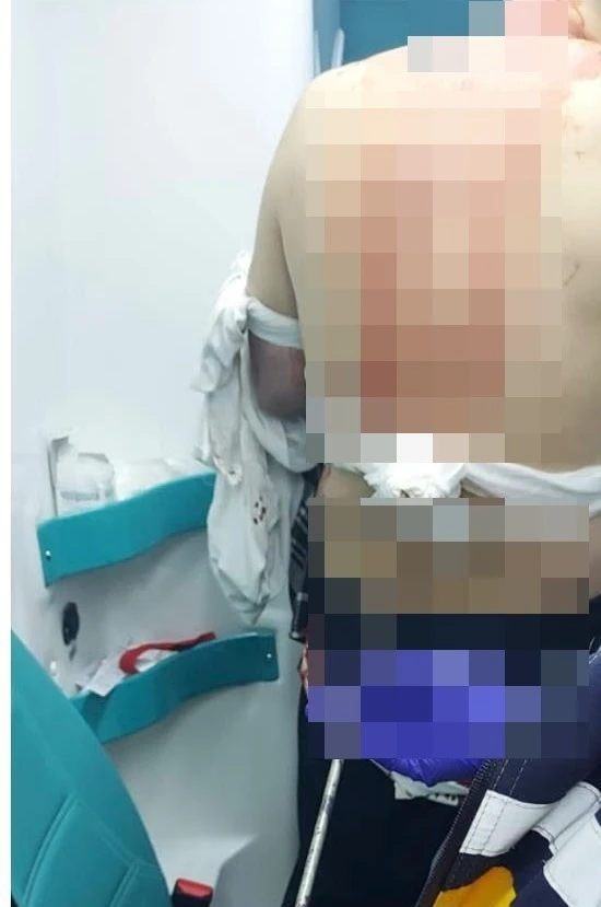Abisini sokak ortasında silahla vurarak öldürdü
