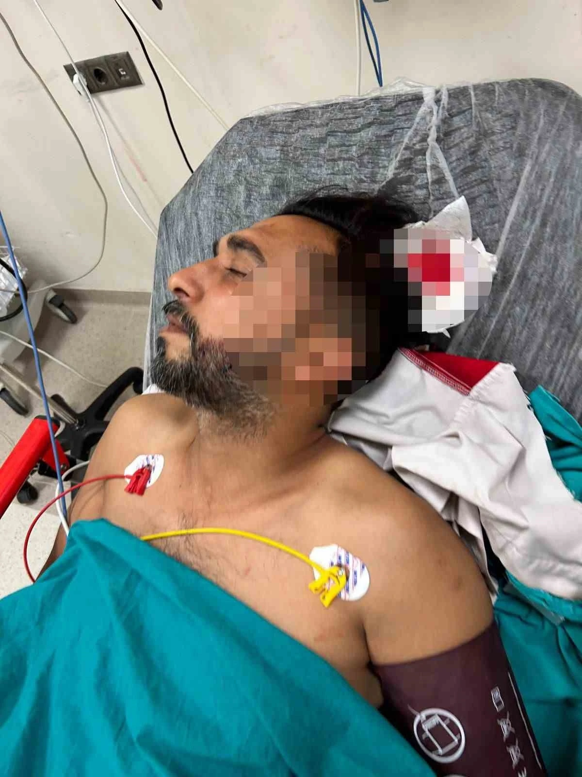 Adana’da döner ustası çalışırken başından yorgun mermiyle yaralandı
