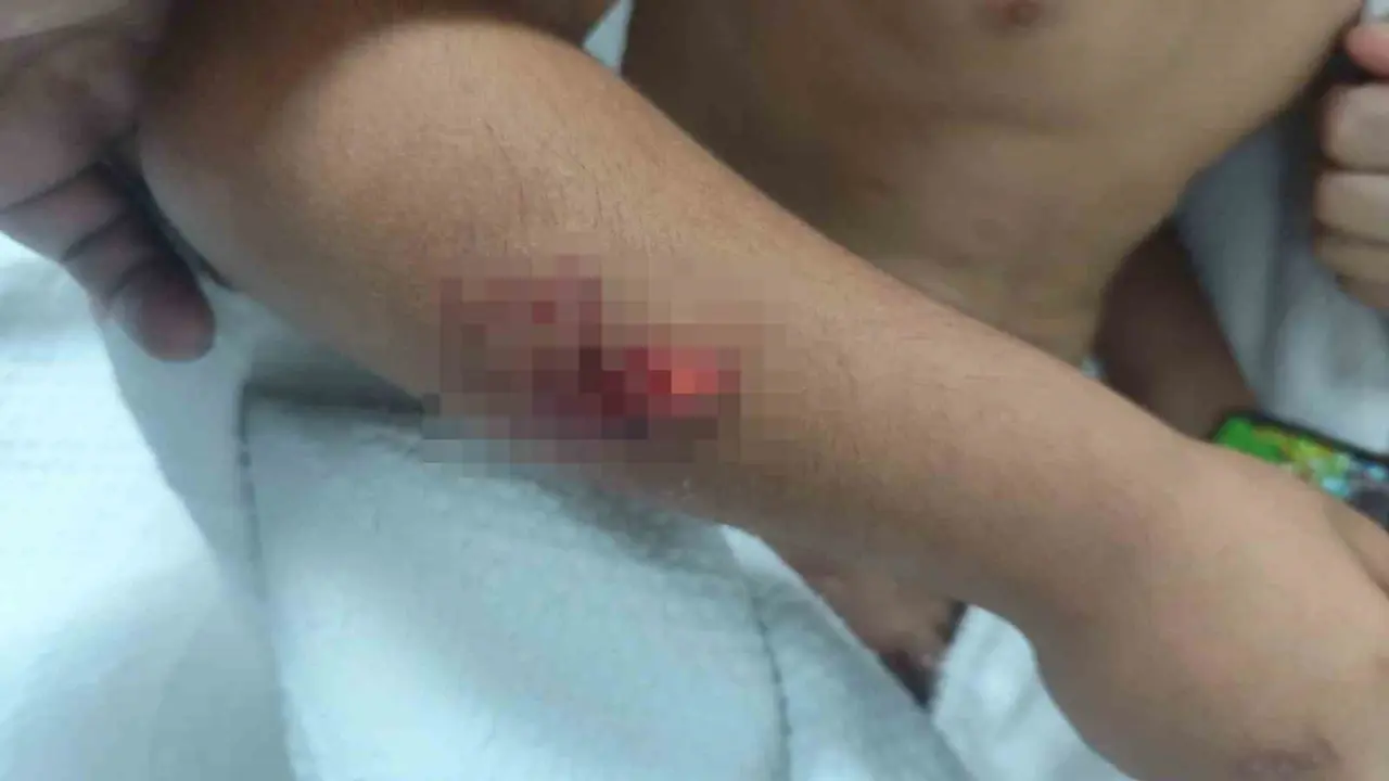 Köpek saldırısına uğrayan çocuğun başına 15 dikiş atıldı