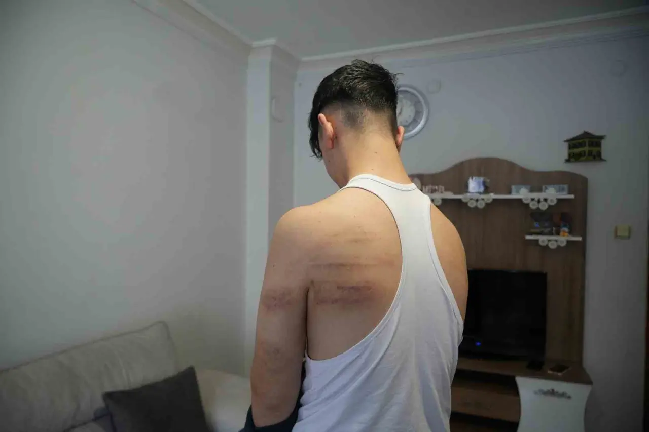 Niğde’de 15 yaşındaki berber çırağına darp iddiası: Önce dövdü, sonra temizlik yaptırdı