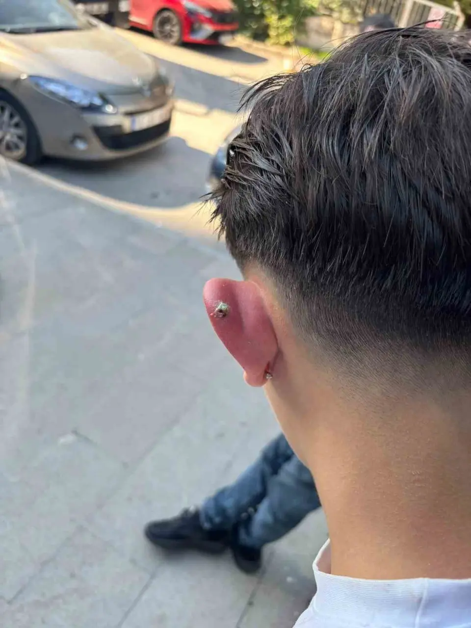 Bursa’da piercing olayında yeni gelişme