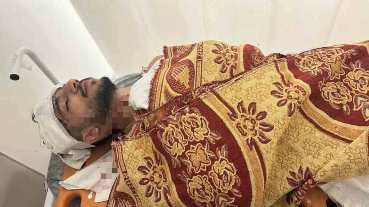 Arnavutköy’de yol verme tartışması kaza ile bitti: Kamyonet sürücüsü taksiye çarpıp kaçtı
