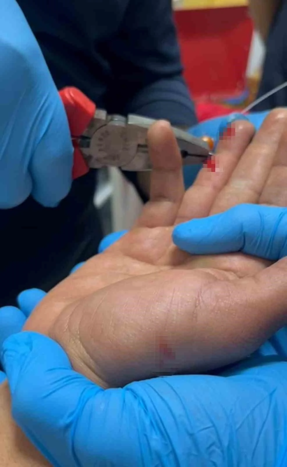 Balık macerası hastanede bitti: Parmağına saplanan olta iğnesini itfaiye &ccedil;ıkarttı
