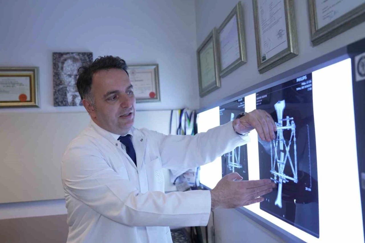 Boy kısalığına karşı modern çözüm: kemik uzatma yöntemleri
