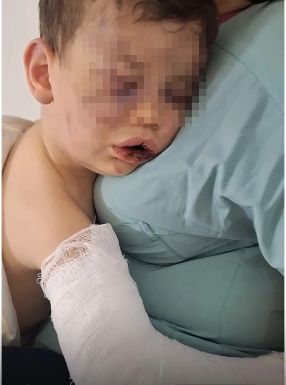 Darp sonucu hastanelik olan bebek devlet korumasına alınacak
