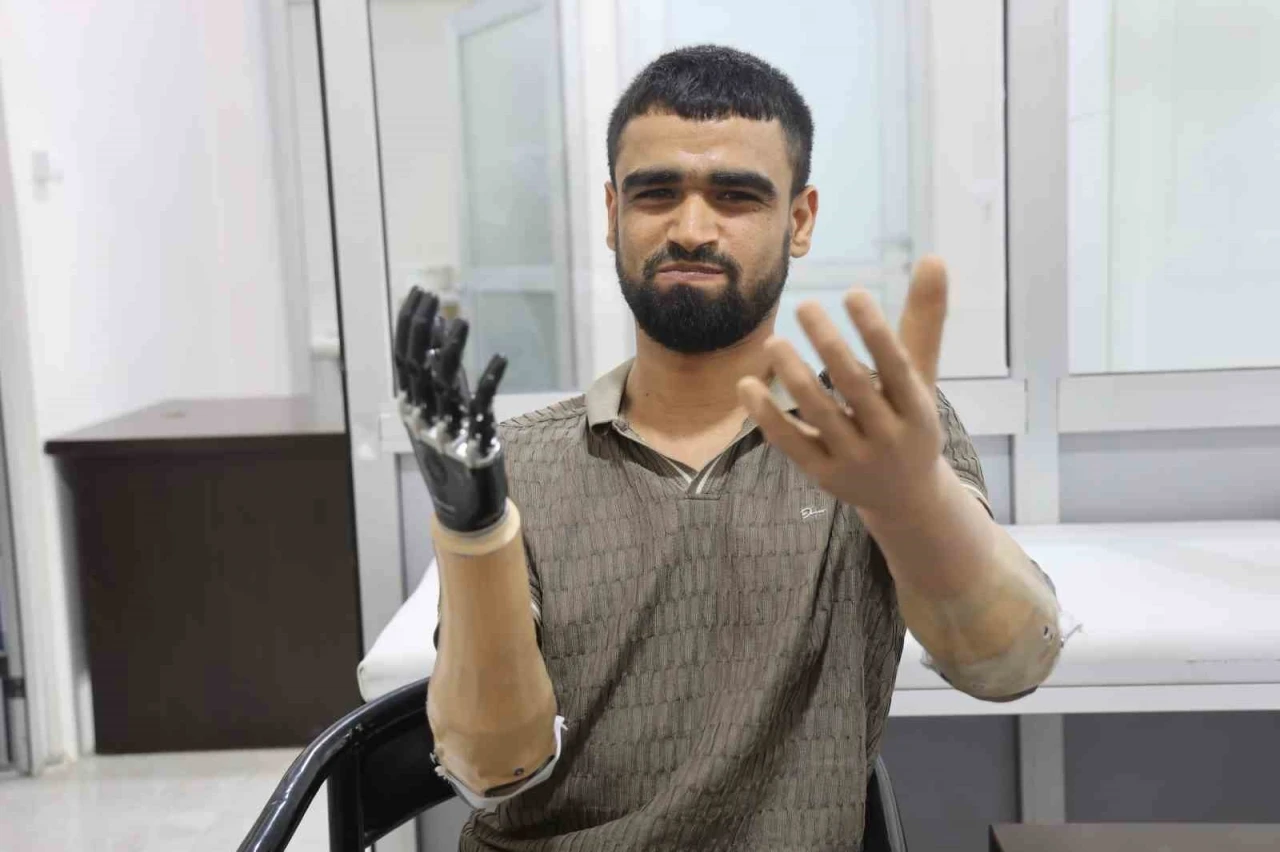 Demirin elektrik tellerine değmesiyle hayatı kararan Muhammed, 3 milyon TL değerindeki protez bacağına ve 2 biyonik koluna kavuştu
