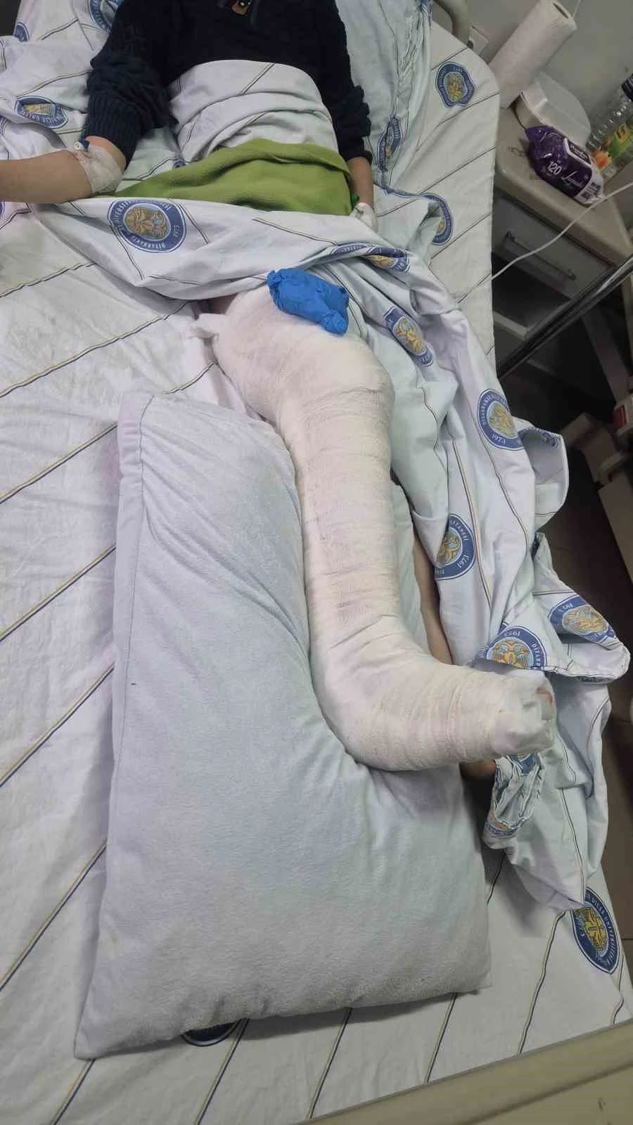 Diyarbakır’da köpeklerden kaçan çocuğun bacağı kırıldı