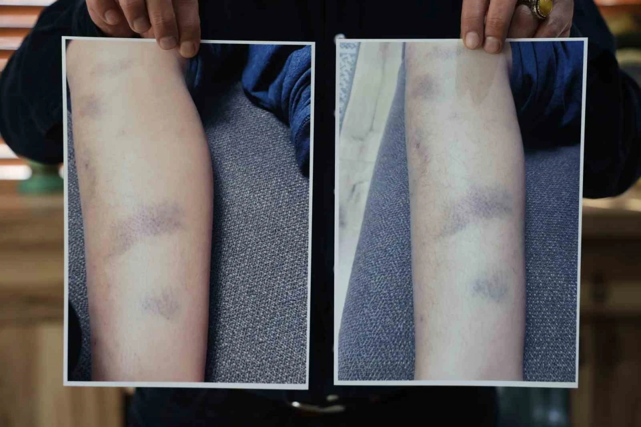 Diyarbakır&rsquo;da &ouml;zel okulda 8 yaşındaki &ccedil;ocuğun darbedildiği iddiası
