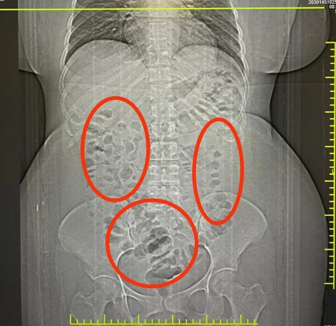 Esenboğa&rsquo;dan Eskişehir&rsquo;e uyuşturucu getiren 2 ş&uuml;pheli yakalandı
