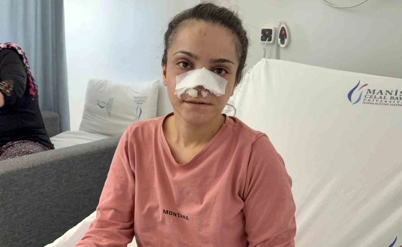 Eşinin kopardığı burnu başarılı operasyonla yerine dikildi
