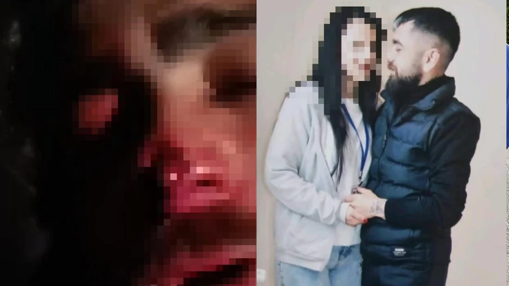 Eski Sevgilisinin Kulağını ve Burnunu Kopardılar!