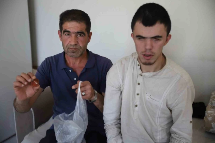 G&ouml;rme engelli gencin yediği sucuktan demir par&ccedil;ası &ccedil;ıktı
