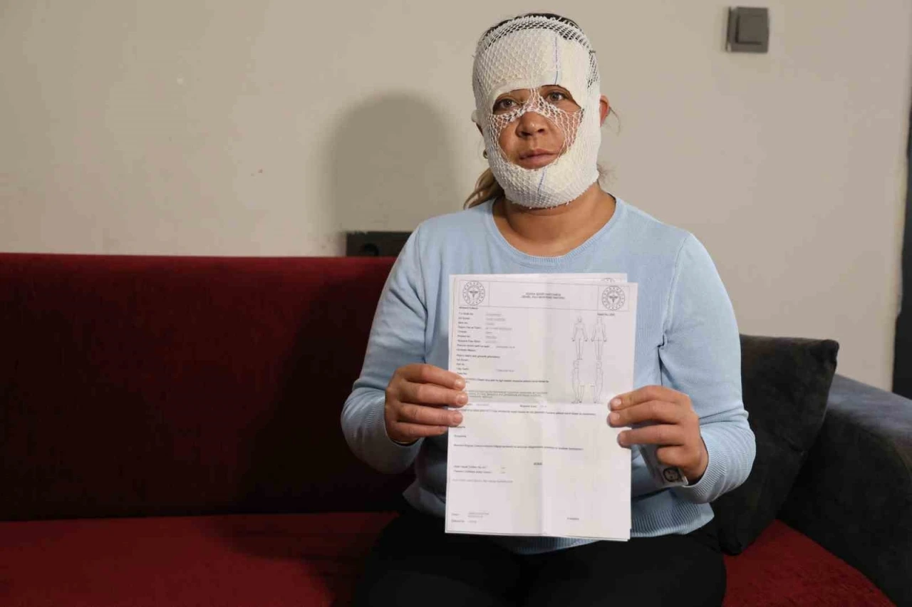 G&uuml;zelleşmek uğruna gittiği merkezde y&uuml;z&uuml; yandı
