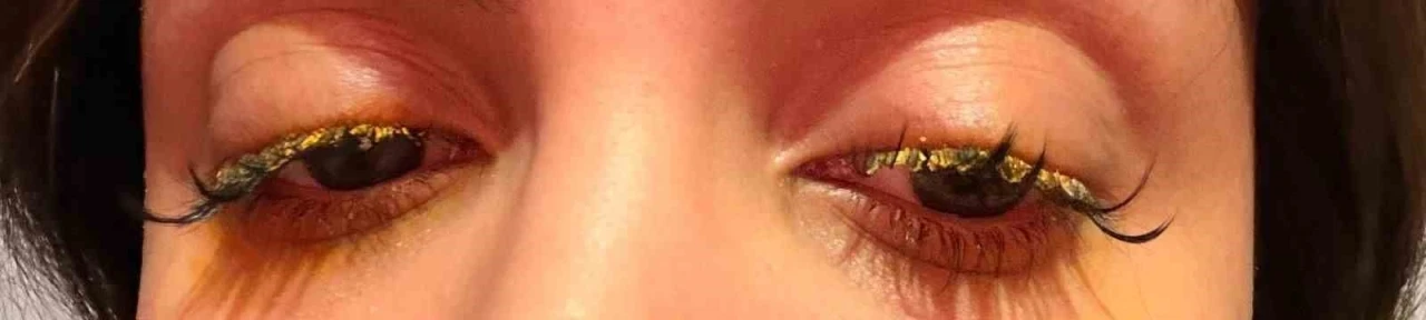 Güzellik merkezinde genç kadının gözüne yapıştırıcı kaçtı: "Kör olabilirdim"
