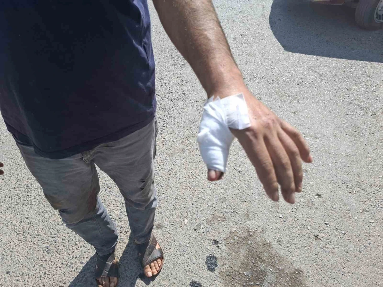 Kahramanmaraş’ta acemi kasaplar hastaneye koştu
