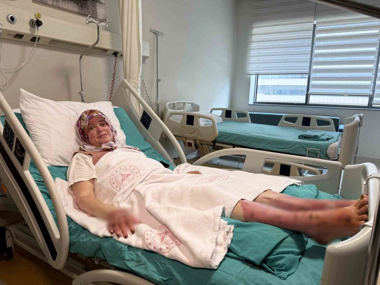 Karavandaki patlama sonrası v&uuml;cudunun y&uuml;zde 70&rsquo;i yandı: "Karadeniz turu yapacaktık, alev topuna d&ouml;nd&uuml;m"
