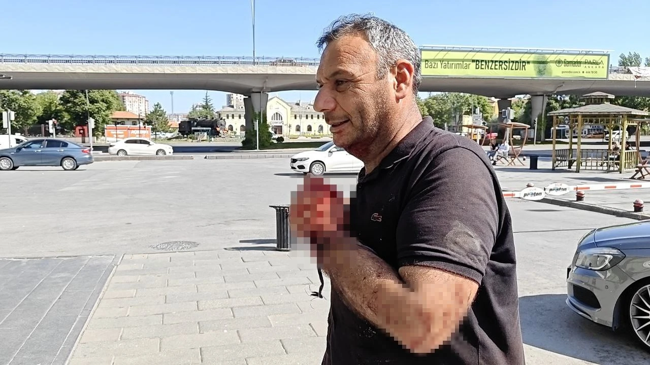 Kayseri’de acemi kasaplar soluğu acil serviste aldı
