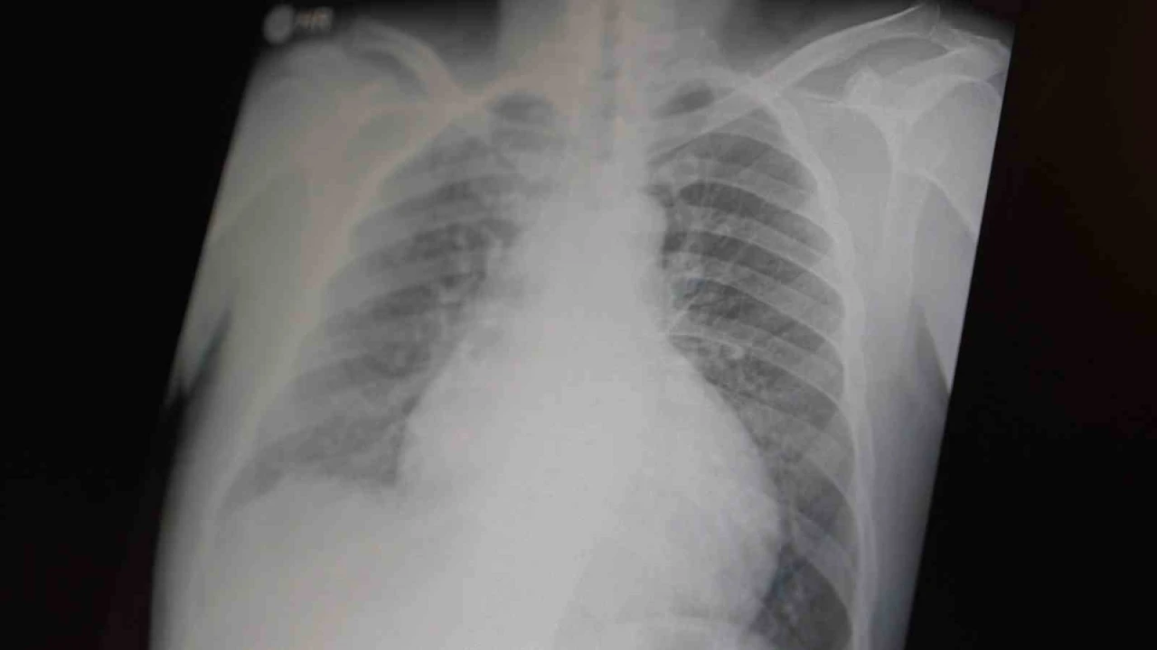 Profes&ouml;r a&ccedil;ıkladı: "Metamfetamin ve kokain gen&ccedil;ler arasında tehlikeli boyutlara ulaştı"
