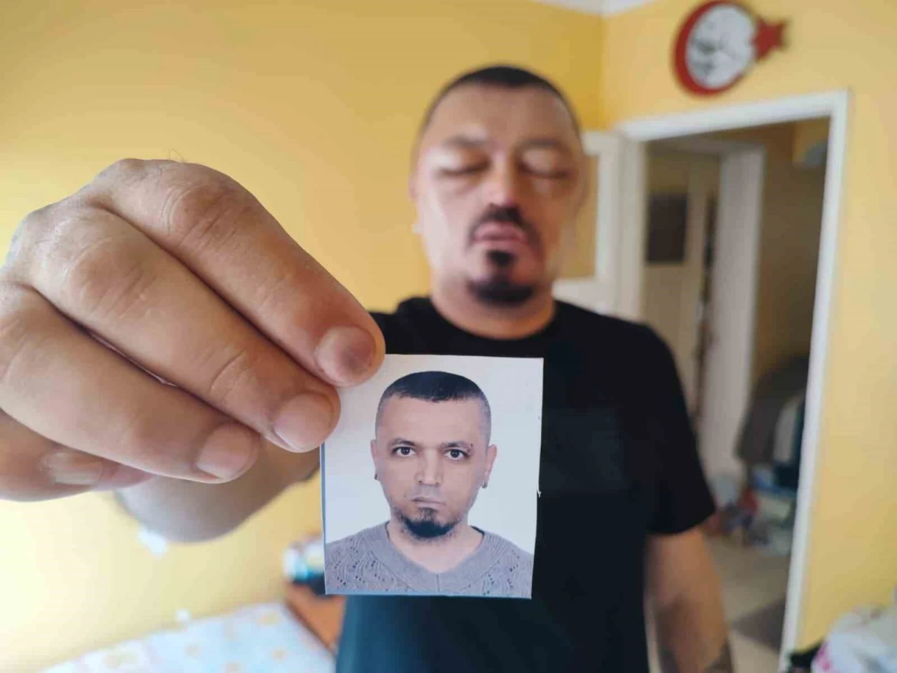 Saçlarını siyahlatmak için aldığı şampuan arı sokmasından beter hale getirdi
