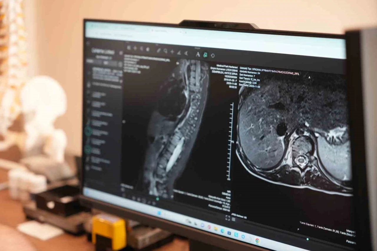 Sinsi ilerleyen bu rahatsızlığı ilk fark eden anneler oluyor
