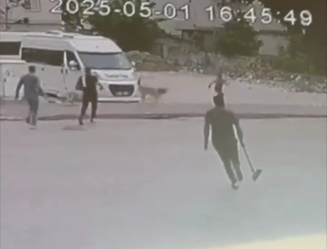 Sokak  köpekleri çocuğa saldırdı
