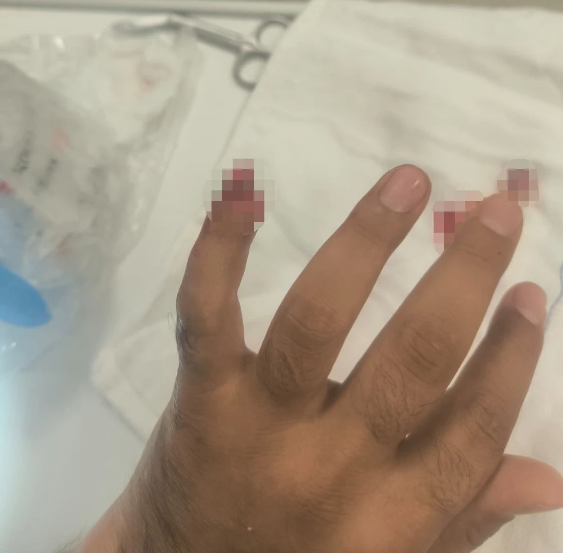 Gözaltına Alınan Şahıs, Polisin Parmağını Kopardı
