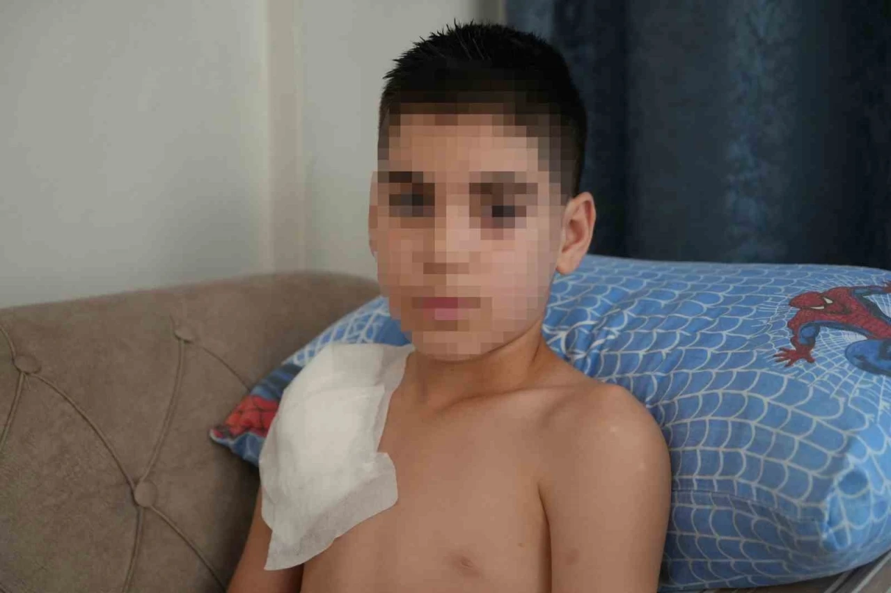 Vücudu köpek tarafından parçalanan Yunus’un kolu kullanılamaz hale geldi, aile adalet arıyor
