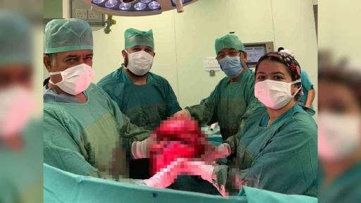 9 Kilogramlık Dev Kitle Başarılı Ameliyatla Çıkarıldı