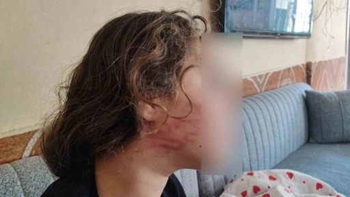 8 yaşındaki kızını darp eden &ccedil;ocuğun epilepsi hastası ablasını sokak ortasında d&ouml;vd&uuml;ğ&uuml; iddiası
