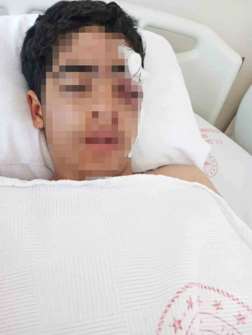 Akran zorbalığına bir yenisi eklendi: 15 yaşındaki &ccedil;ocuk muştayla &ouml;ld&uuml;resiye d&ouml;v&uuml;ld&uuml;
