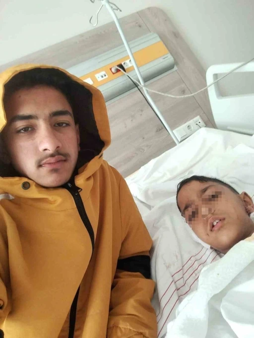 Ankara&rsquo;da sokak k&ouml;peğinin saldırısına uğrayan &ccedil;ocuk yaralandı
