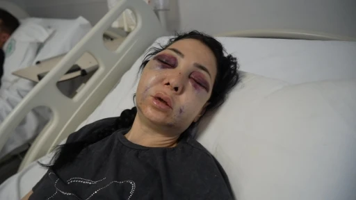Anne ve oğlunun darp edilmesine ilişkin g&ouml;zaltına alınan 3 ş&uuml;pheliden 1&rsquo;i tutuklandı
