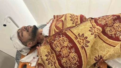 Arnavutköy’de yol verme tartışması kaza ile bitti: Kamyonet sürücüsü taksiye çarpıp kaçtı
