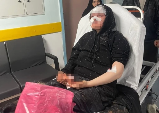 Boşanmak isteyen kadın eşi tarafından &ouml;ld&uuml;resiye darp edildi
