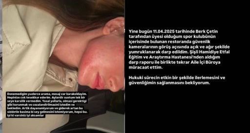 Danla Biliç, Eski Sevgilisi Tarafından Darp Edildi