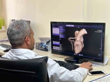 Diyarbakır’da kalp hastalıkları Kardiyak MR ile etkili ve hızlı teşhis ediliyor
