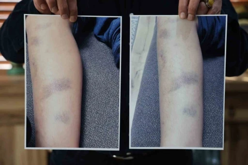 Diyarbakır&rsquo;da &ouml;zel okulda 8 yaşındaki &ccedil;ocuğun darbedildiği iddiası
