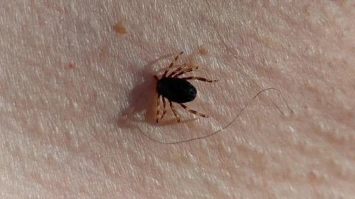 Doğu Karadeniz&rsquo;de kene sezonu sakin ge&ccedil;iyor

