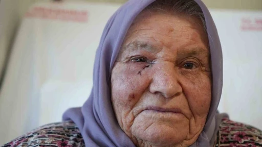 Dört mevsim gözyaşı yağmuru, bir cerrahiyle güneşle buluştu
