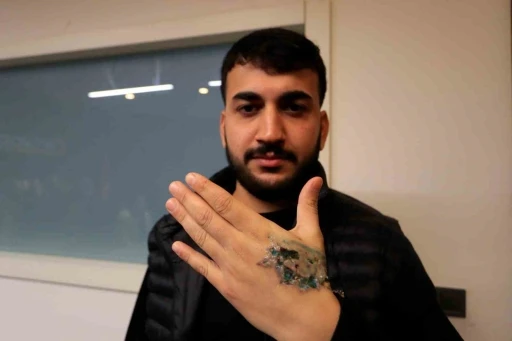 D&ouml;vme sildirmek isterken kabusu yaşadı, elindeki dokular &ouml;ld&uuml;
