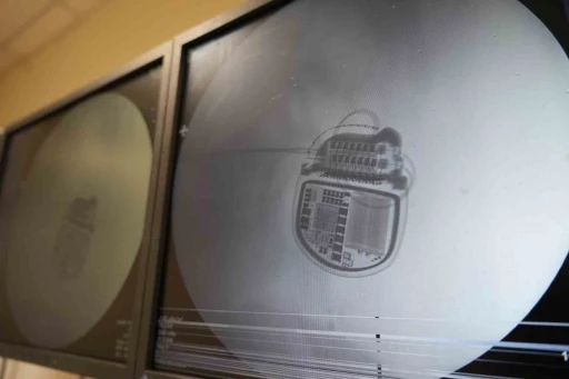 Ge&ccedil;meyen ağrılara OM&Uuml;&rsquo;de umut: Hastalar ağrı piliyle yeniden hayata tutunuyor
