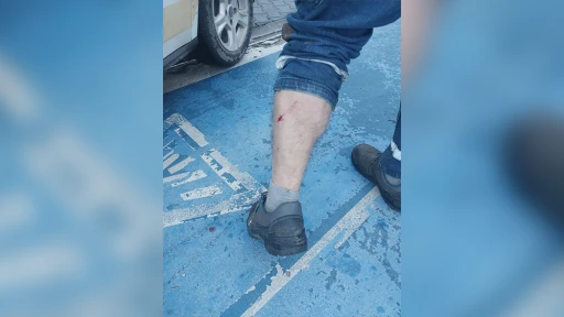 İçmeler’de Belediye Çalışanına Yaban Domuzu Saldırdı