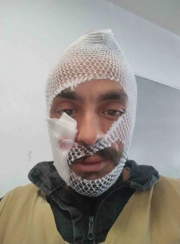 İneğinin boynuz darbeleri ile yaralanan gencin paylaşımı gülümsetti
