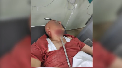 İşçinin Yüzüne İnşaat Demiri Saplandı