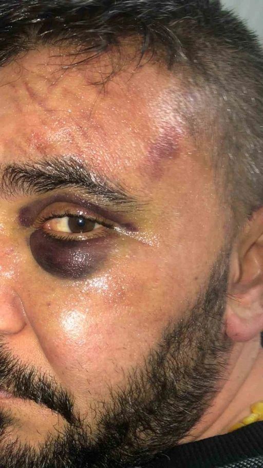 İsyeri sahibi d&uuml;kkanında &ouml;ld&uuml;resiye darp edildi
