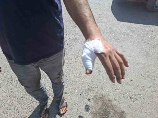 Kahramanmaraş’ta acemi kasaplar hastaneye koştu
