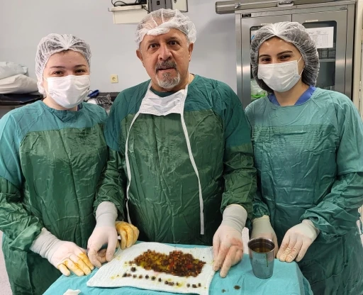 Karın ağrısıyla gitti, safrasından binlerce taş &ccedil;ıktı