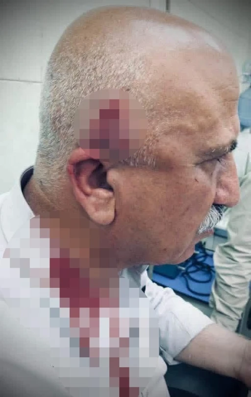 Kerk&uuml;k&rsquo;te ka&ccedil;ak yapı yıkımı sırasında kaymakama bı&ccedil;aklı ve sopalı saldırı
